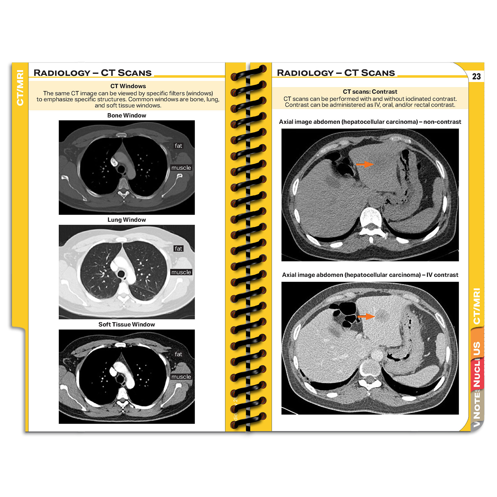 MDpocket Radiology &amp; Imaging